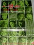 一磅肉.